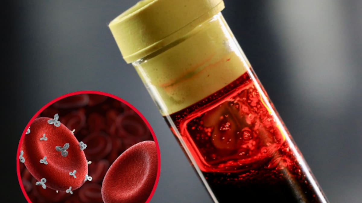 Rh nulo el tipo de sangre más raro del mundo: ¿Cuál es la mutación que lo provoca?