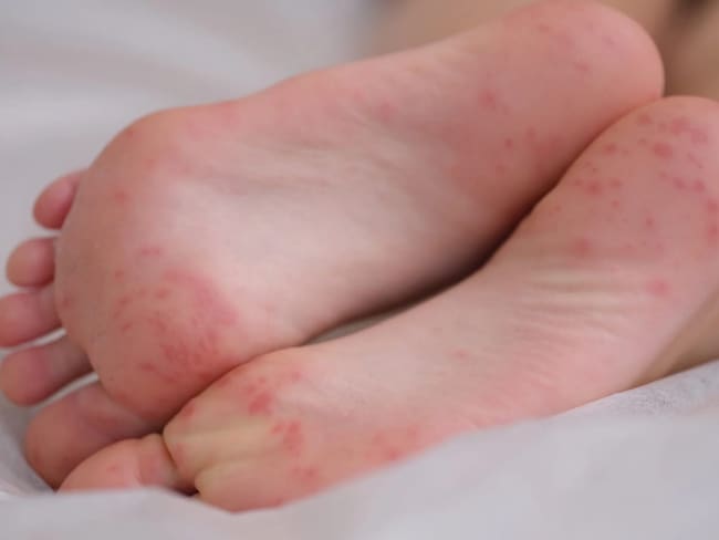 Liliana Quintero, epidemióloga de Armenia