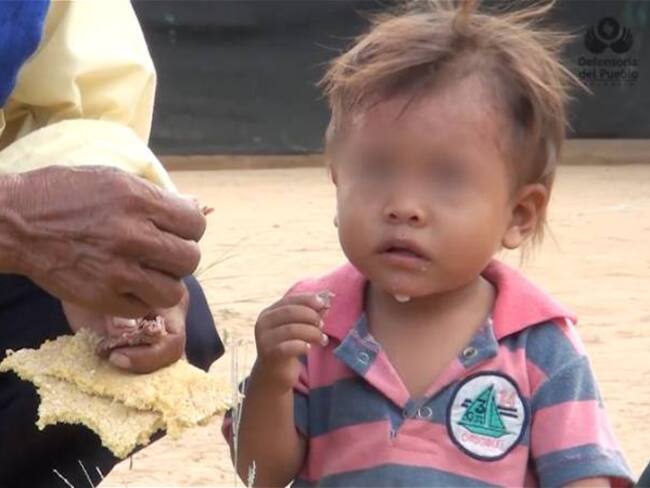 137 casos de muerte por desnutrición están siendo analizados por el INS