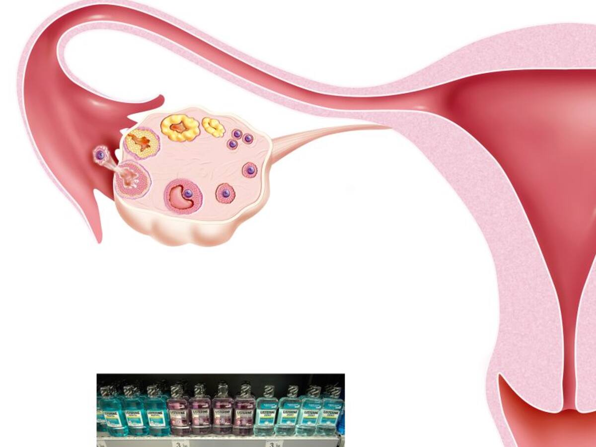 Médico aclara tema sobre hacerse duchas vaginales con enjuague bucal