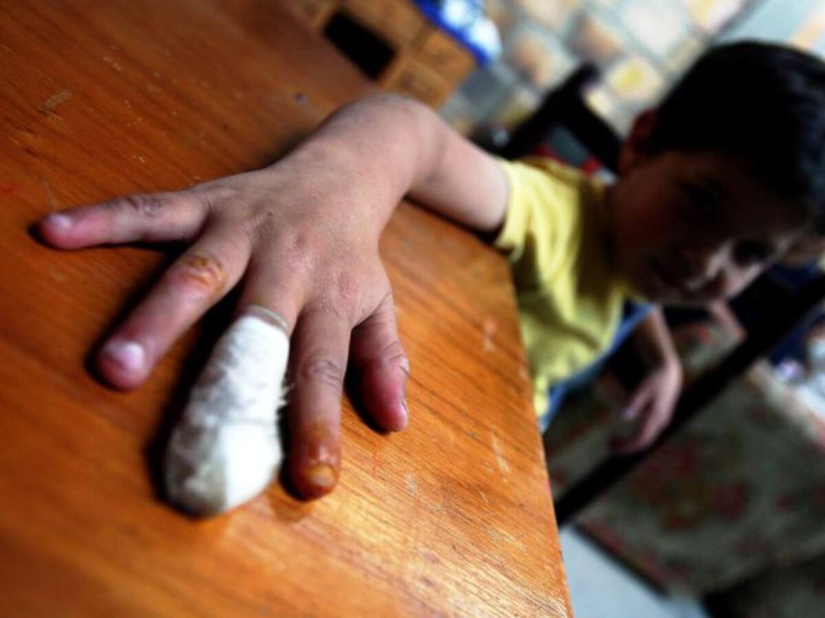 Autoridades de Cartagena buscan lograr cero quemados este año