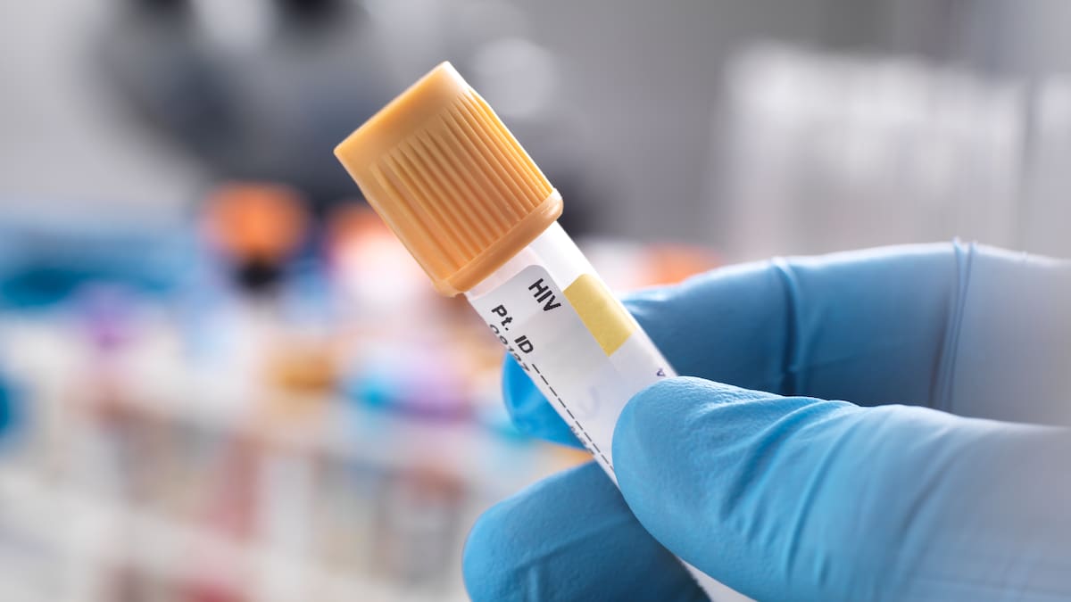 Estudio revela que inyecciones semestrales podrían ofrecer protección del 100% contra el VIH