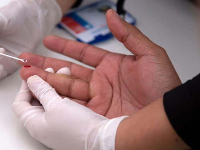 Más de 100 casos de VIH se han registrado en Pereira en el último trimestre