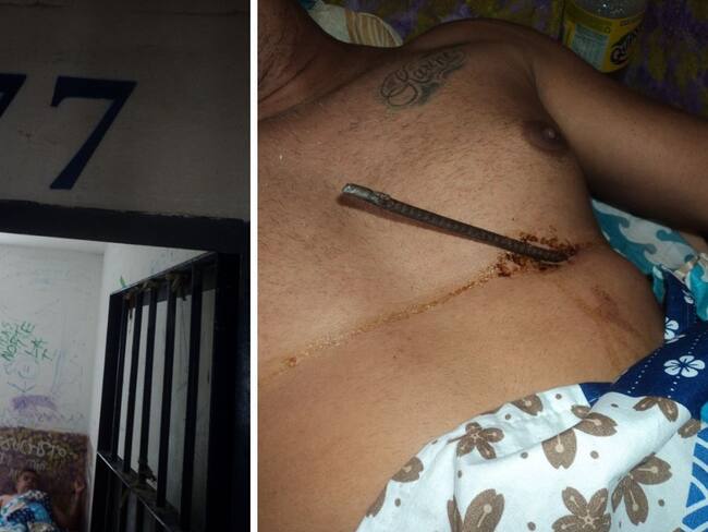 Interno de Santander se autolesionó con una varilla para pedir que lo cambien de cárcel