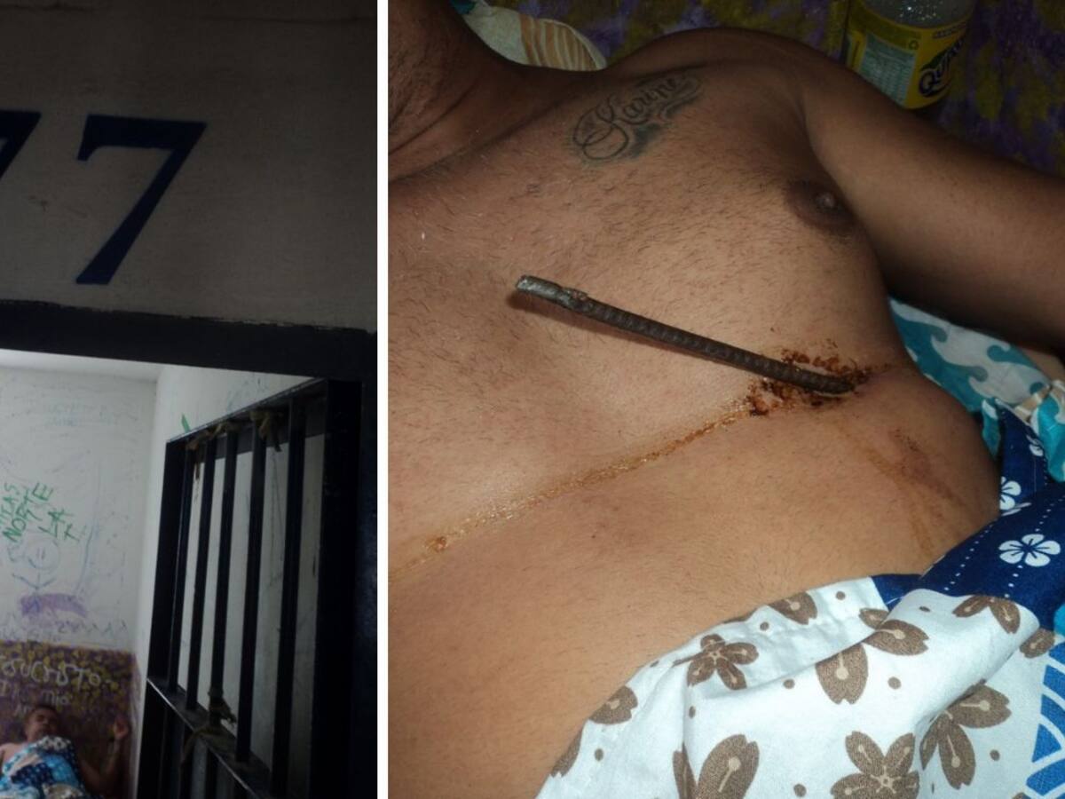 Interno de Santander se autolesionó con una varilla para pedir que lo cambien de cárcel