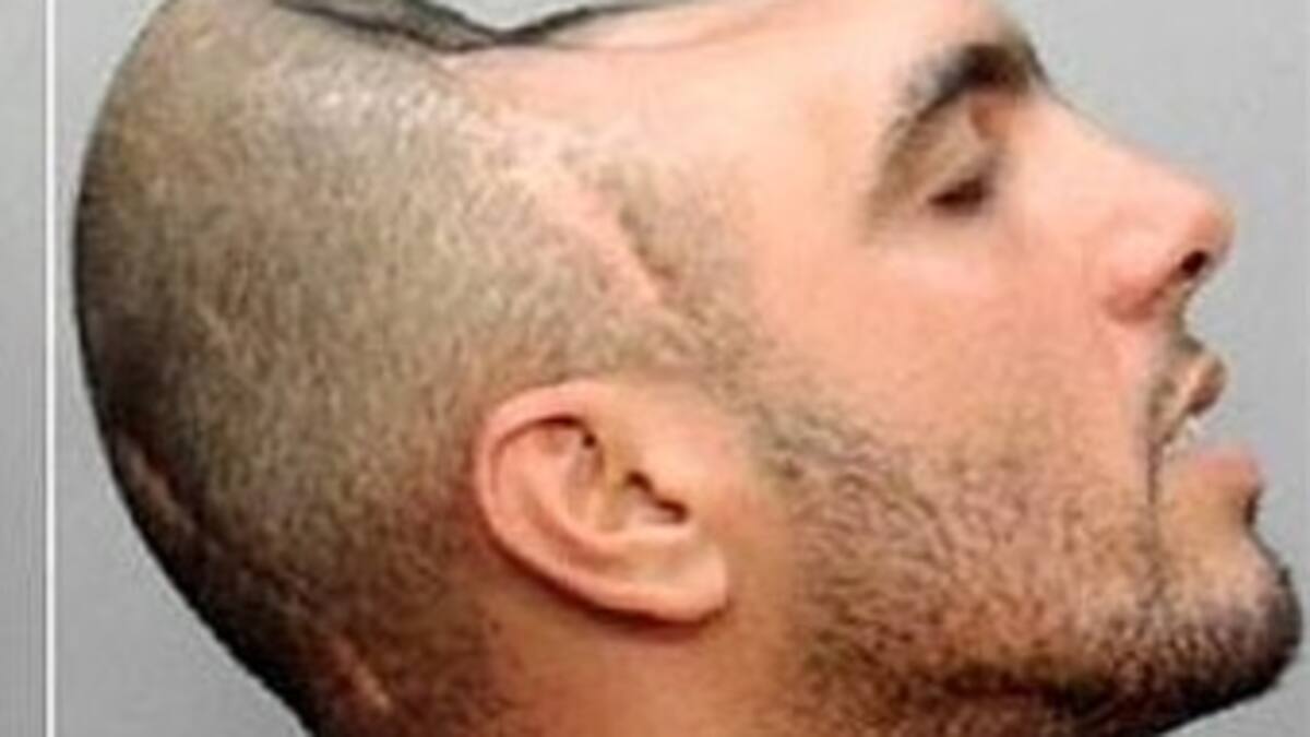 El extraño caso de 'El hombre con media cabeza'