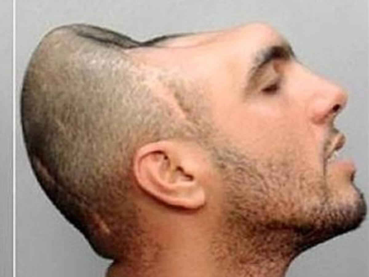 El extraño caso de 'El hombre con media cabeza'