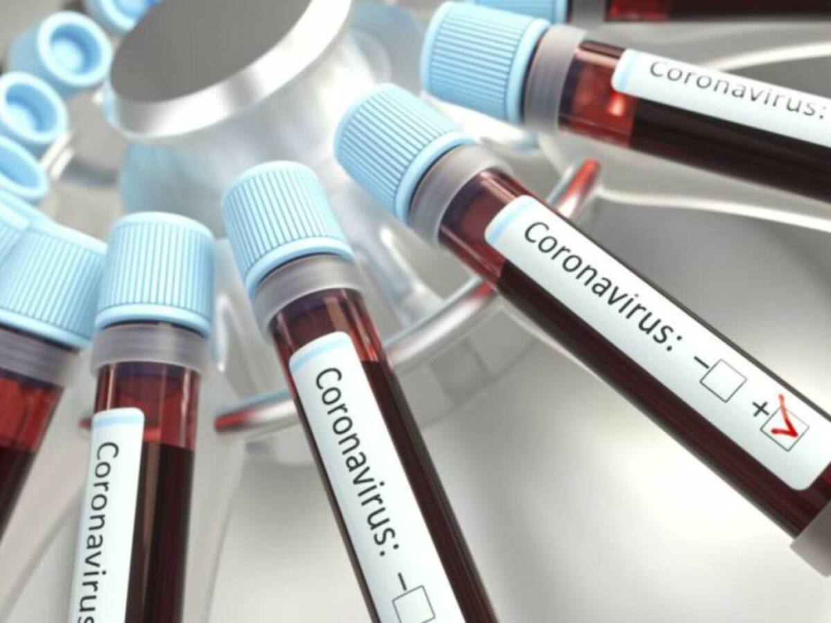 Se eleva a 29 el número de personas contagias con Covid-19 en Risaralda
