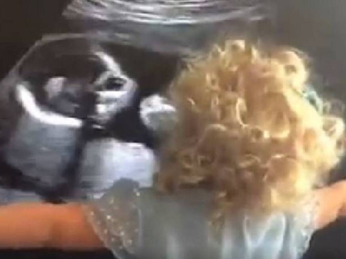 Bebé se emociona al ver la ecografía de su hermana