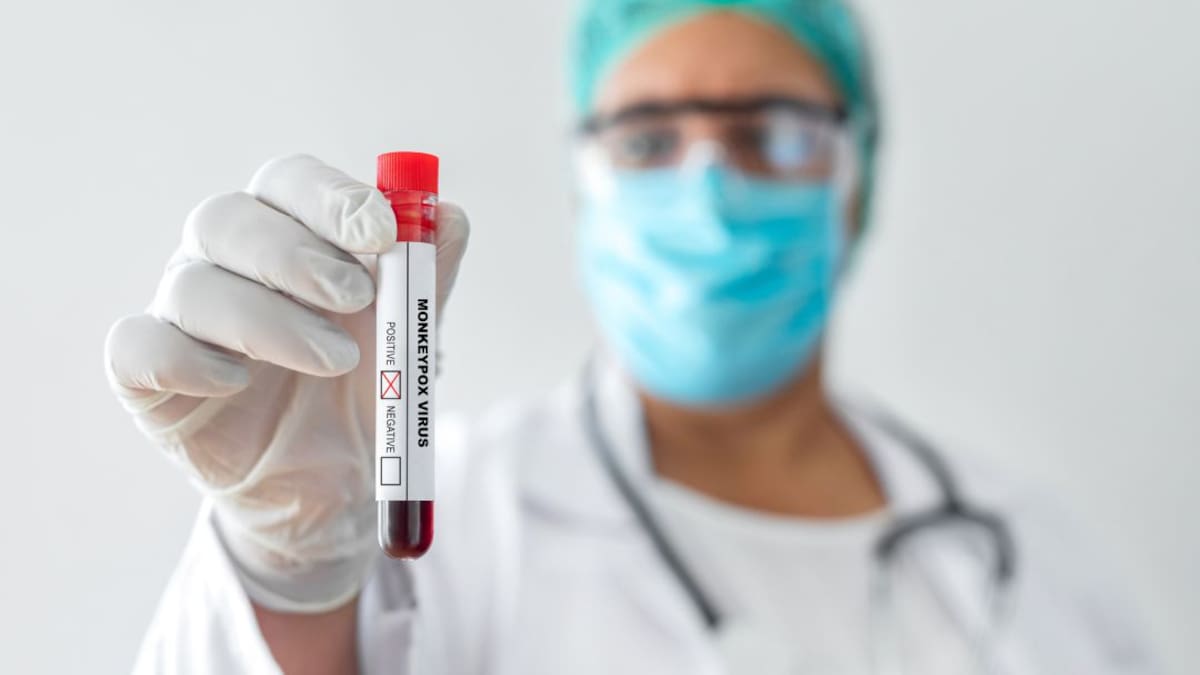 Viruela del mono en Colombia: contagios, cómo se transmite y gravedad