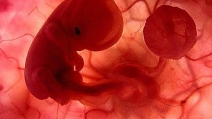 "La maternidad es posible en cualquier momento" Fernando Sánchez.