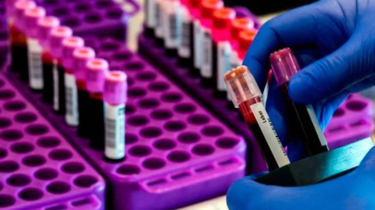Primer muerto en Risaralda como consecuencia del Coronavirus