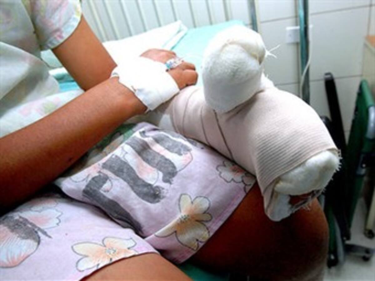 Padres de niños quemados deben perder la patria potestad: Defensoría del Pueblo