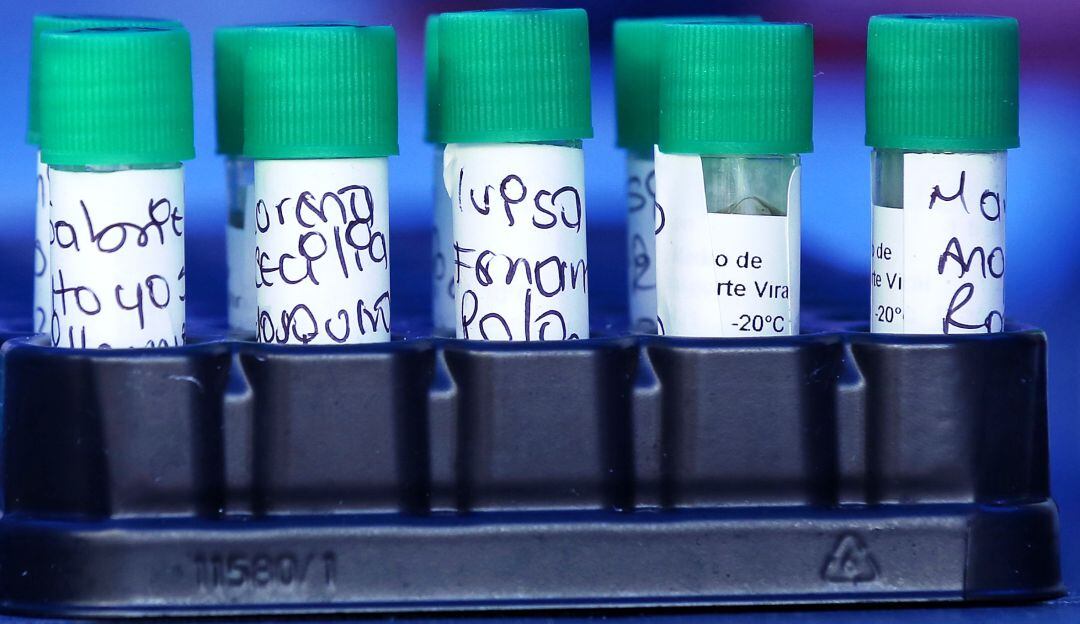 Coronavirus en Bolívar: 107 nuevos casos y un fallecido