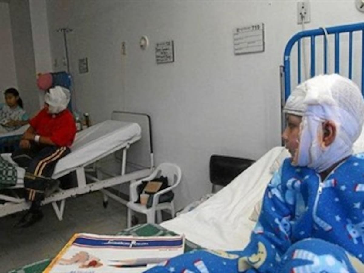 En Antioquia hay 150 quemados y seis amputados por pólvora