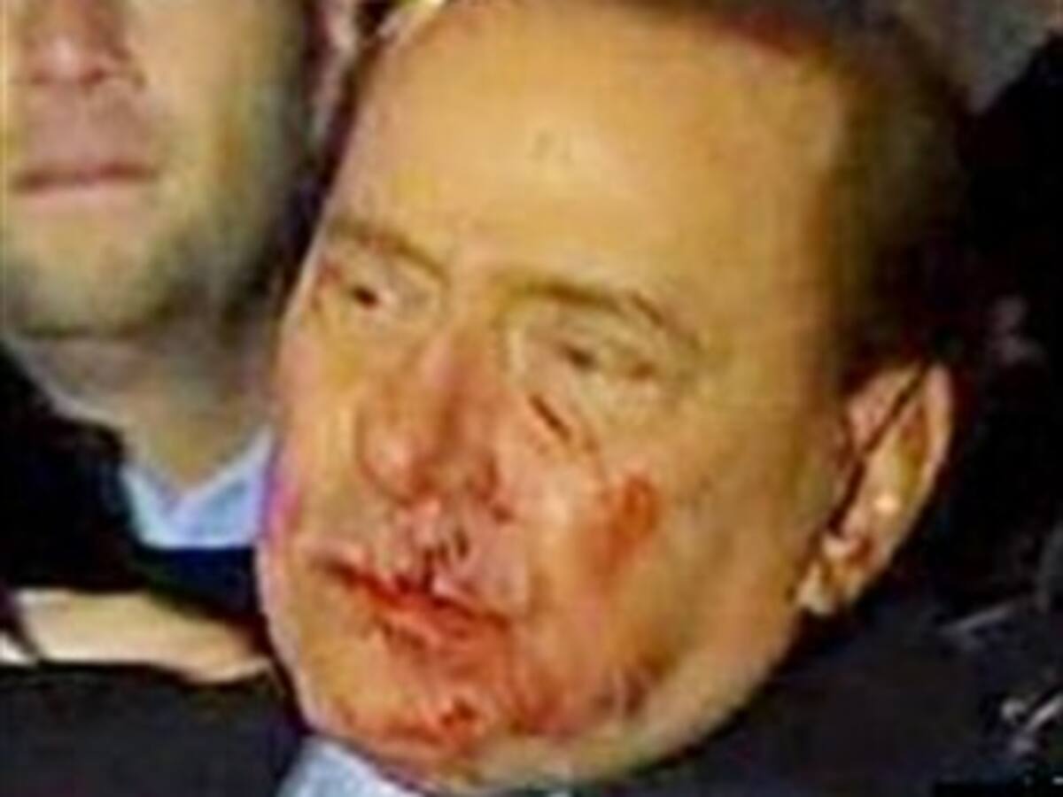 De un puñetazo le rompen la cara al ministro italiano, Silvio Berlusconi