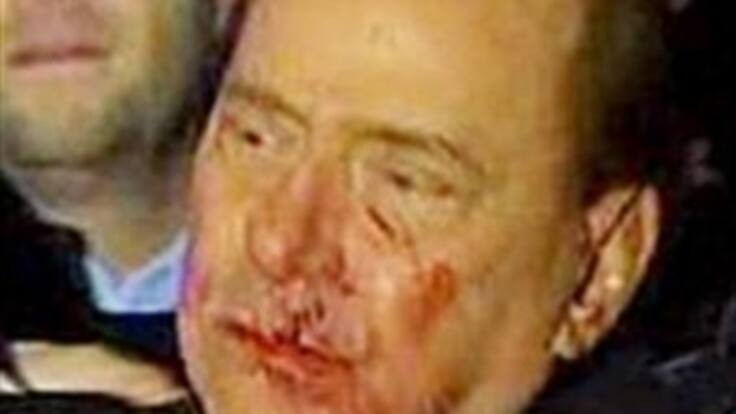 De un puñetazo le rompen la cara al ministro italiano, Silvio Berlusconi