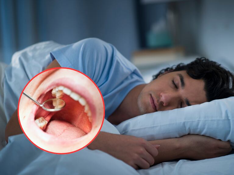 Hombre durmiendo en su cama / Persona revisando sus dientes con el odontólogo (Getty Images)