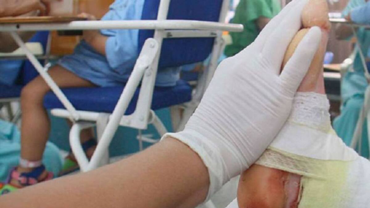 Tres nuevos lesionados con pólvora en Risaralda durante la noche de Navidad