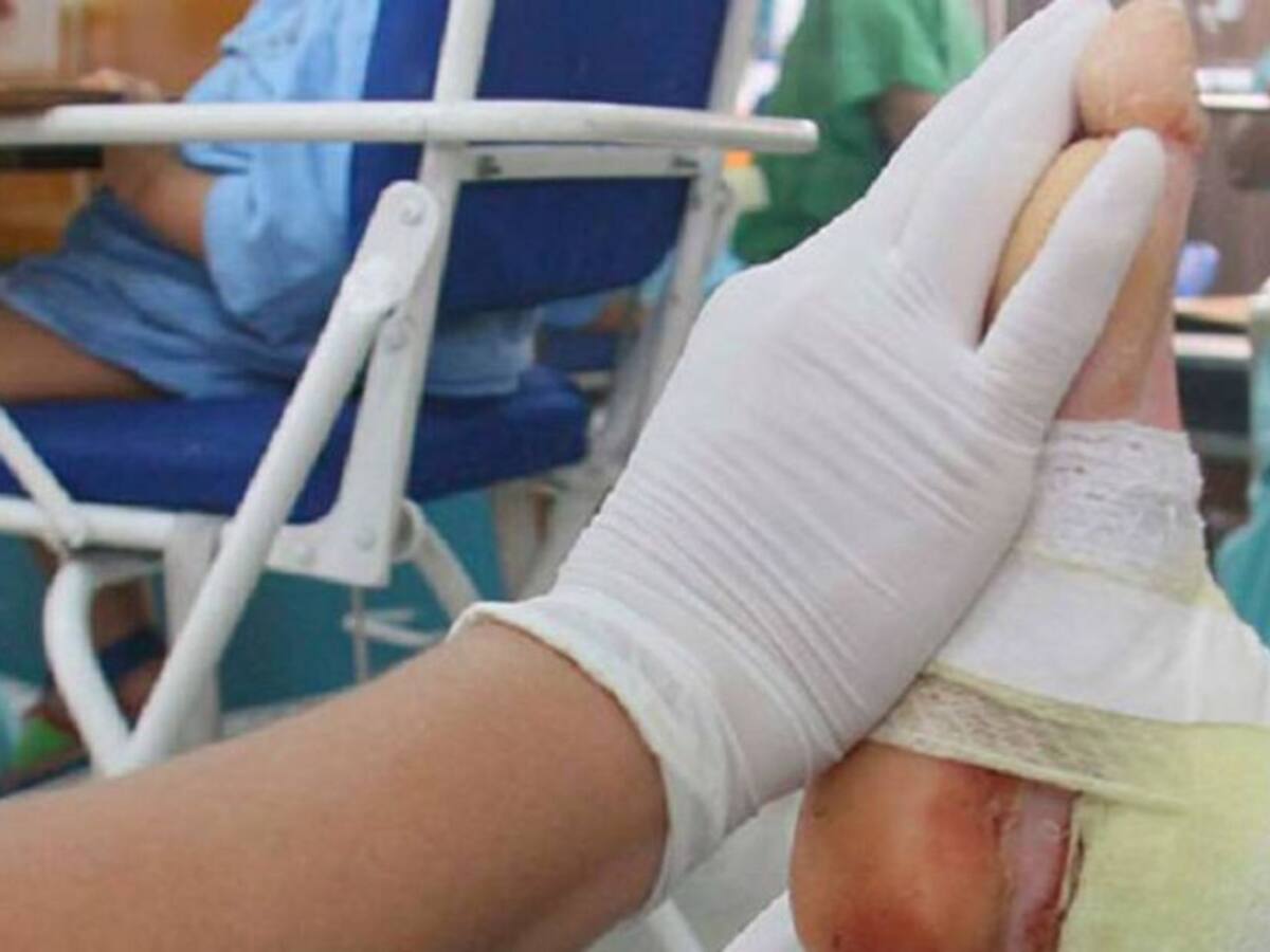 Tres nuevos lesionados con pólvora en Risaralda durante la noche de Navidad