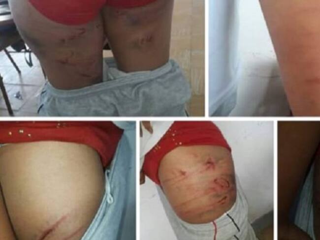 Polémica en Risaralda por brutal agresión de una madre a su hija