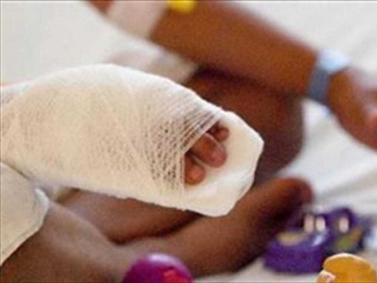 Llega a 100 el número de quemados con pólvora en Antioquia