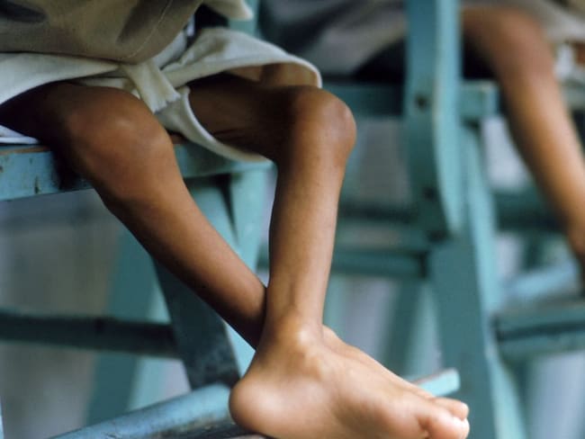En Colombia siguen muriendo niños por falta de alimentación