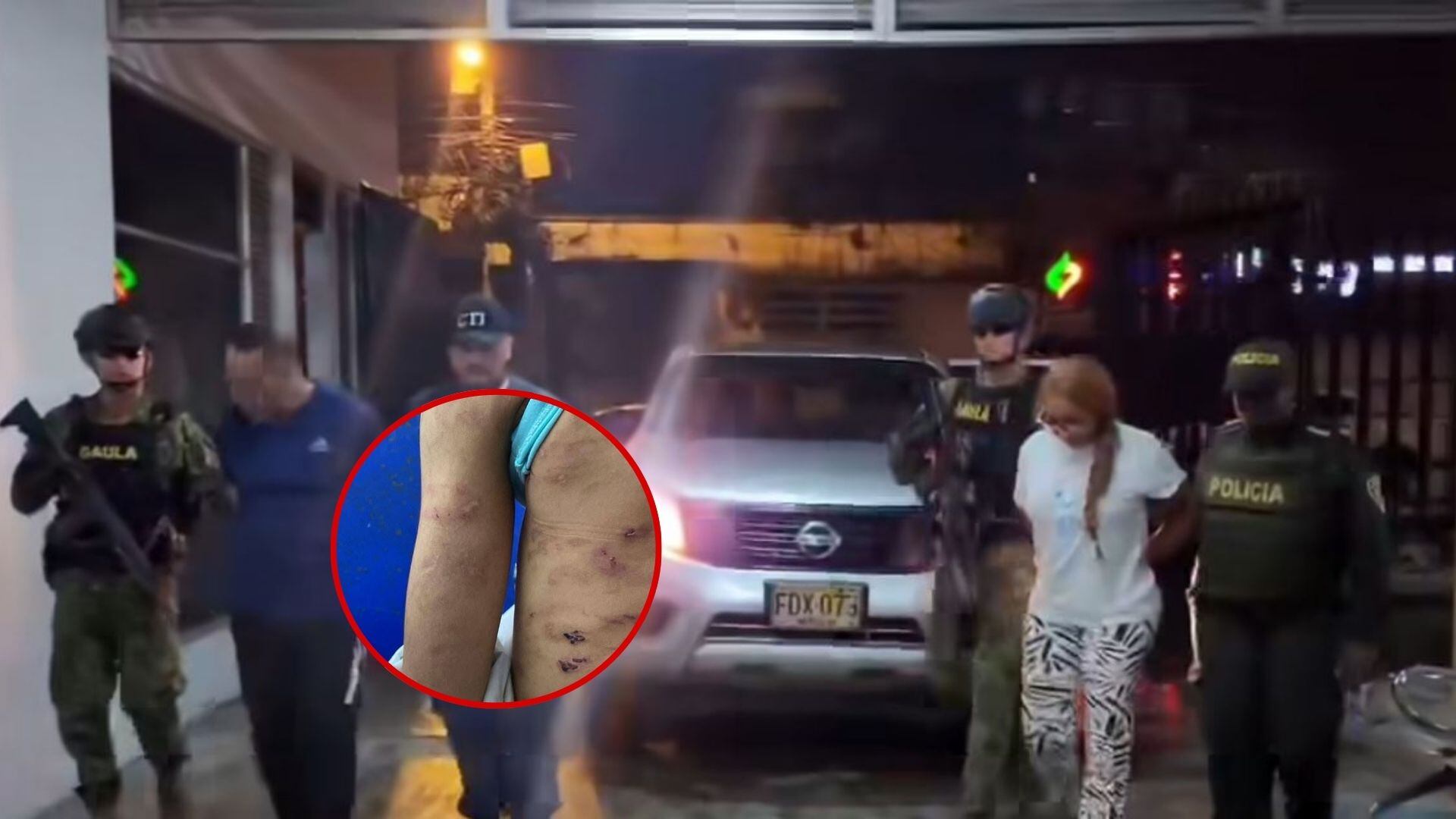 Capturan en Cali a pareja acusada de brutal maltrato infantil en Buenaventura