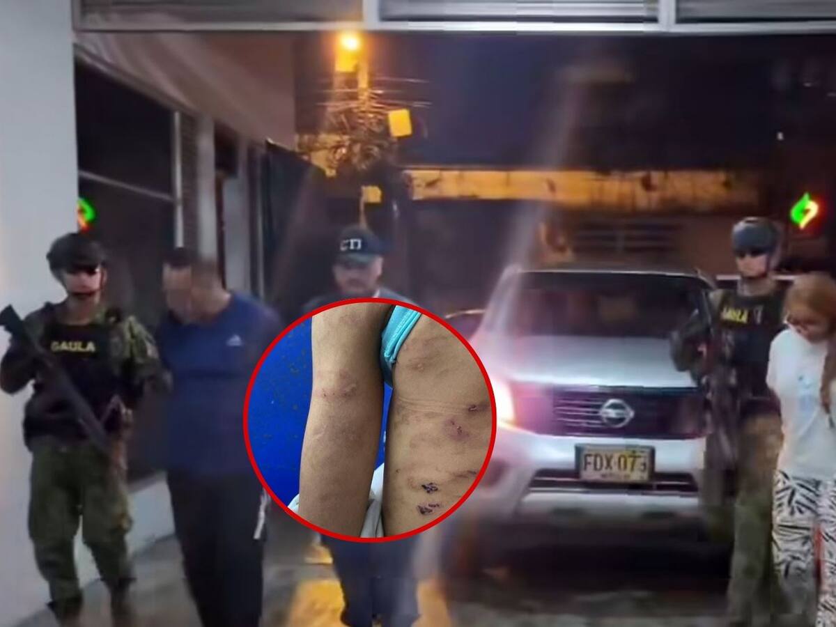 Capturan en Cali a pareja acusada de brutal maltrato infantil en Buenaventura