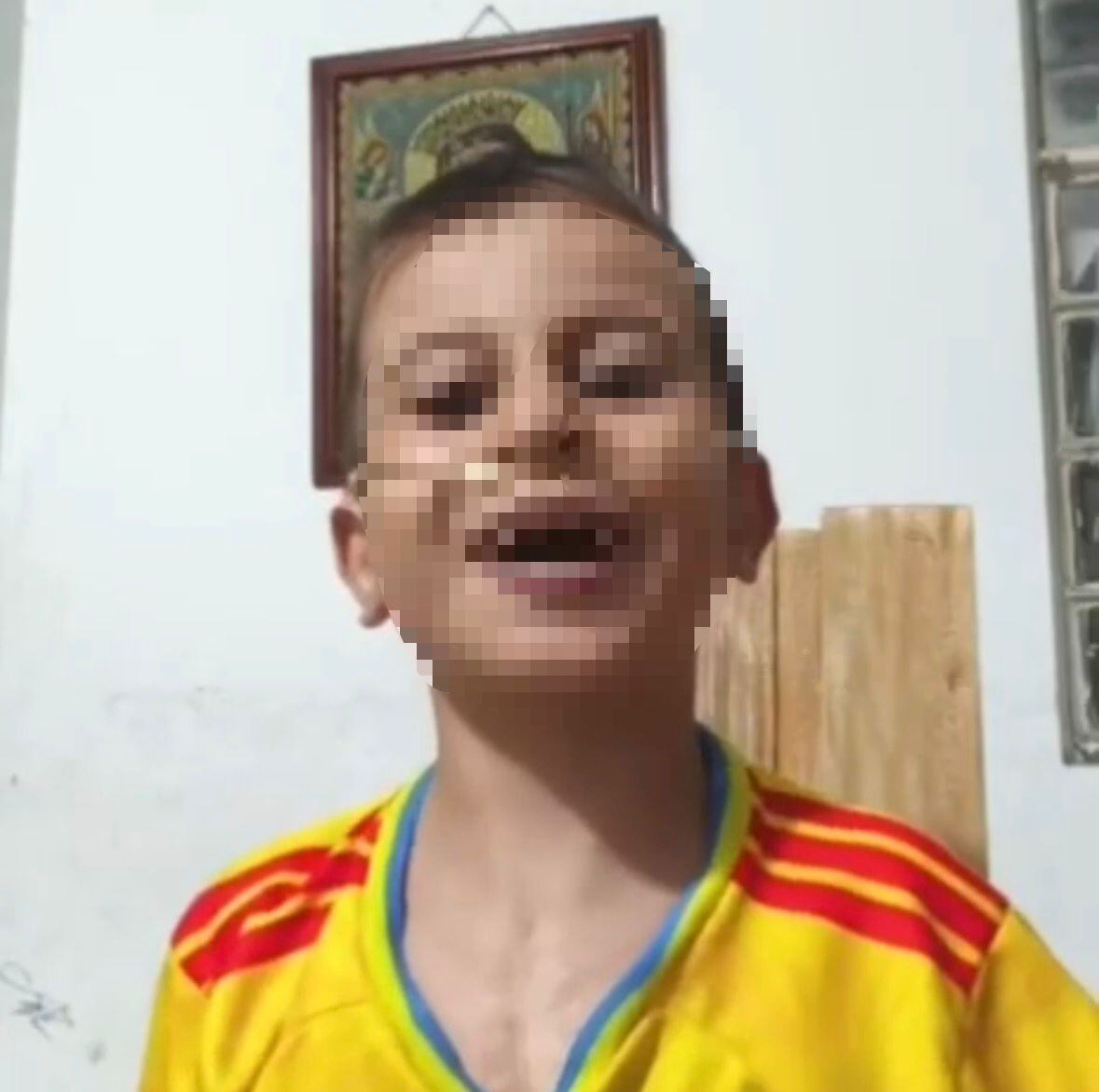 Gobierno Nacional se compromete a garantizar atención médica urgente para niño de 7 años en Cúcuta. / Foto: Tomada de video compartido por la familia.