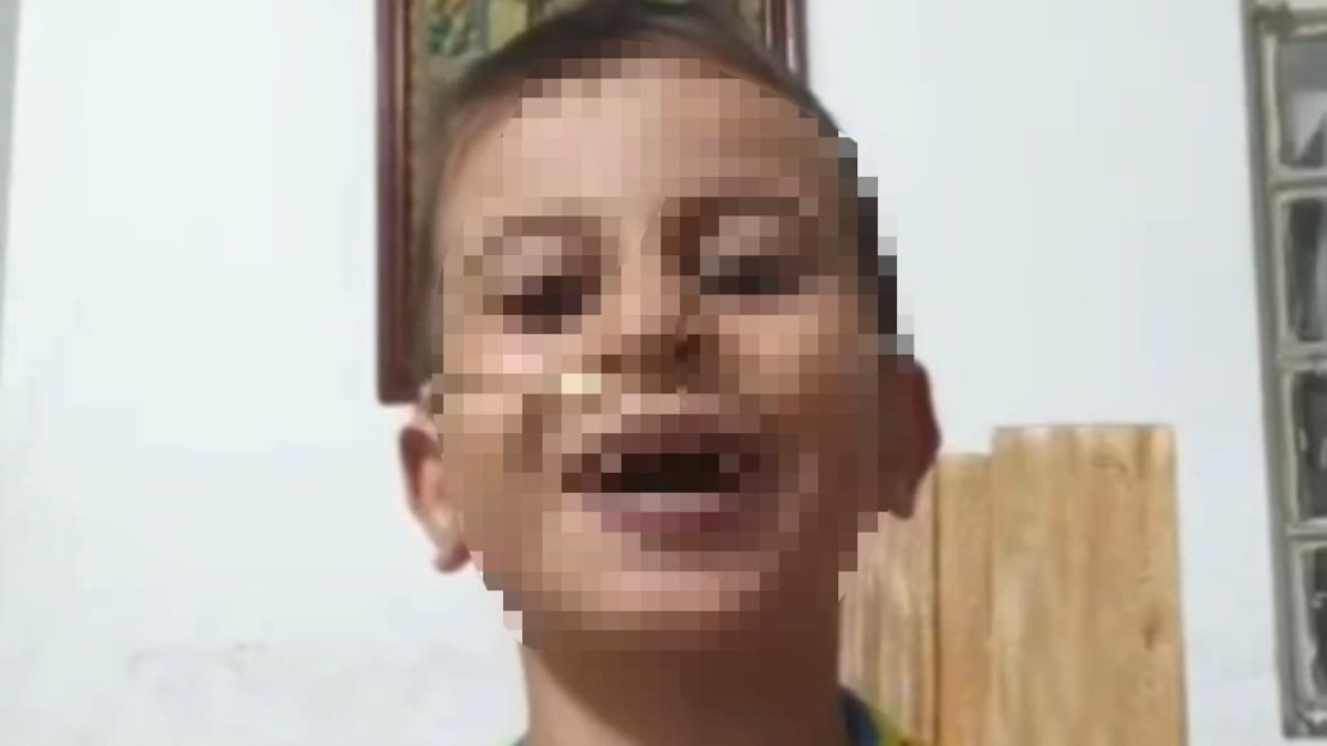 Lucas Murillo, niño de 7 años, será trasladado a Bucaramanga para recibir atención médica