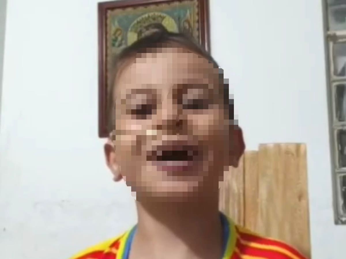 Lucas Murillo, niño de 7 años, será trasladado a Bucaramanga para recibir atención médica