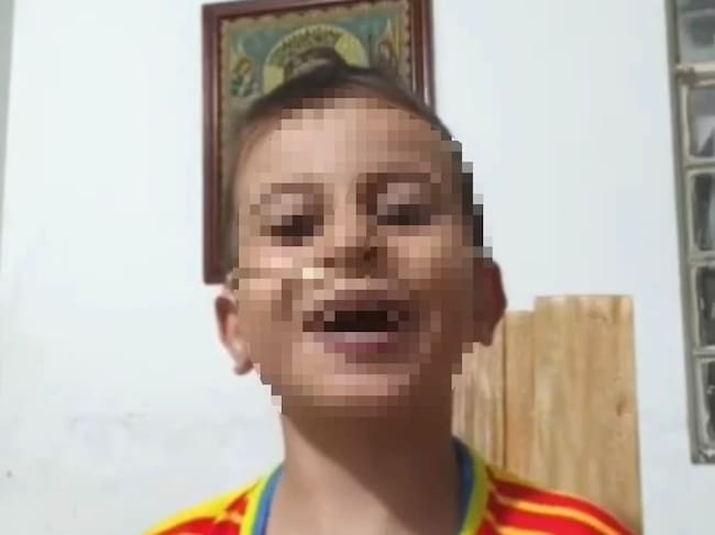 Gobierno Nacional se compromete a garantizar atención médica urgente para niño de 7 años en Cúcuta. / Foto: Tomada de video compartido por la familia.