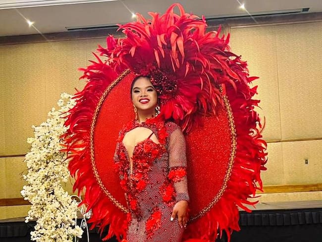 Con su carisma, fortaleza y sonrisa, Valerie ya es reina: una reina de lucha, de esperanza y de inclusión. Un ejemplo vivo de que la belleza más grande es la que nace del corazón