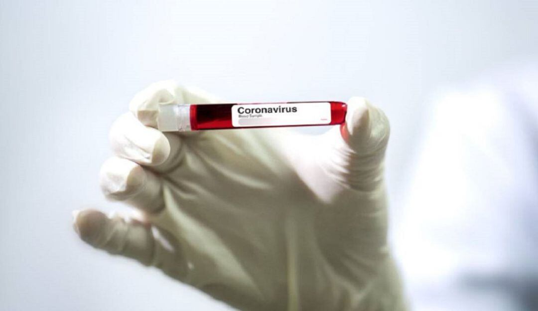 Coronavirus en Caldas