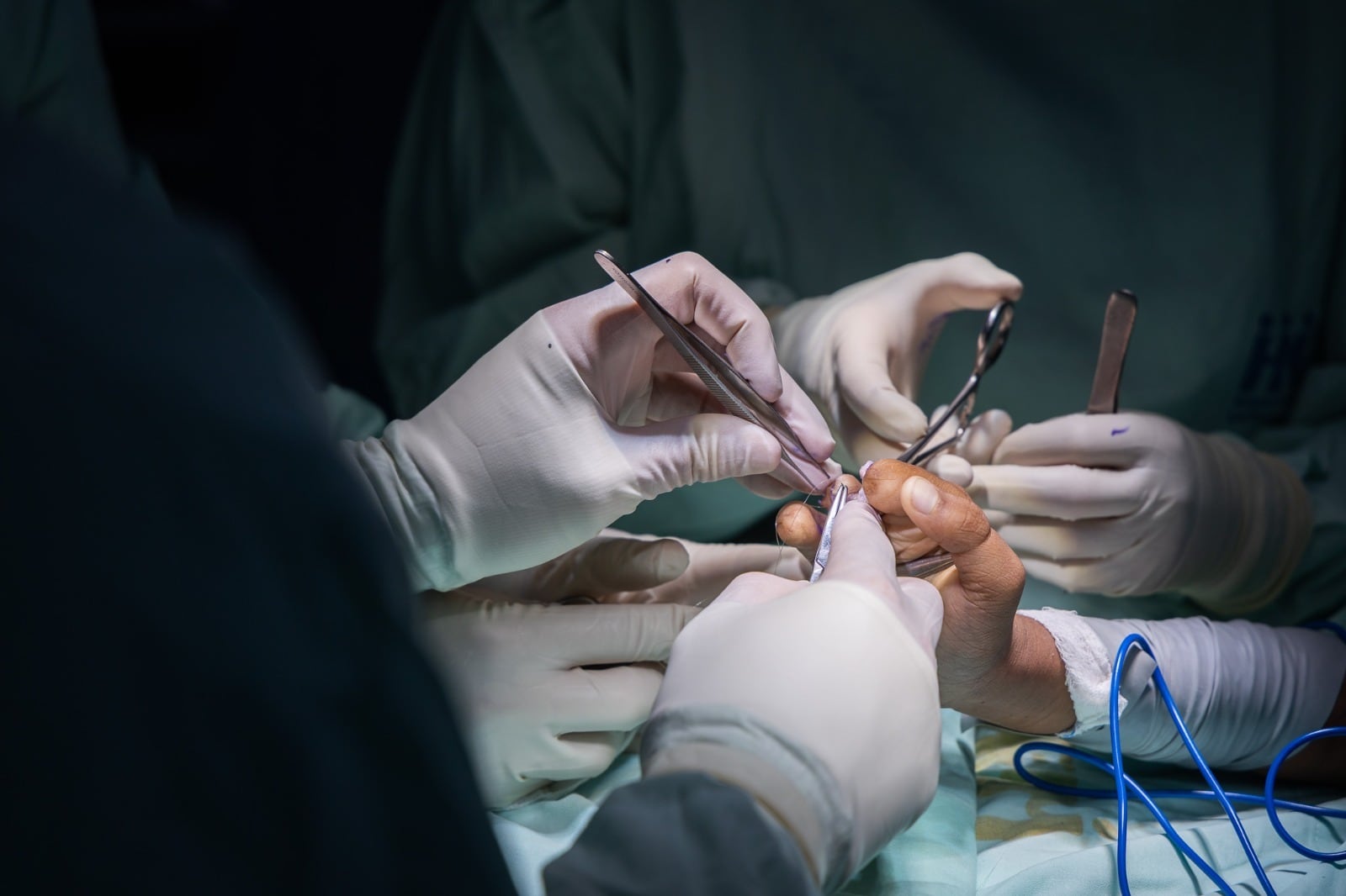 Cirugía de manos para niños en Medellín. Foto: alcaldía.