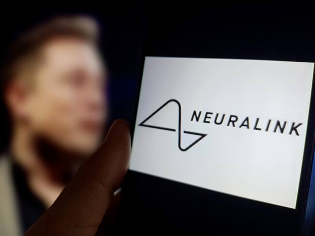 Ilustración de la compañía Neuroalink junto a su fundador, Elon Musk. (Foto:  CFOTO/Future Publishing via Getty Images)
