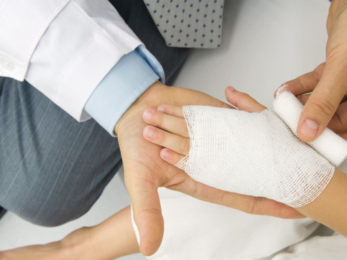 "En Colombia hay 118 quemados en lo que va de diciembre"