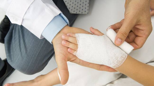 Quemados por pólvora.