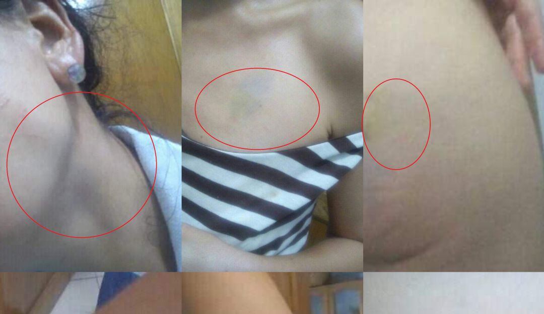 Agresiones físicas contra Claudia Soraya. 