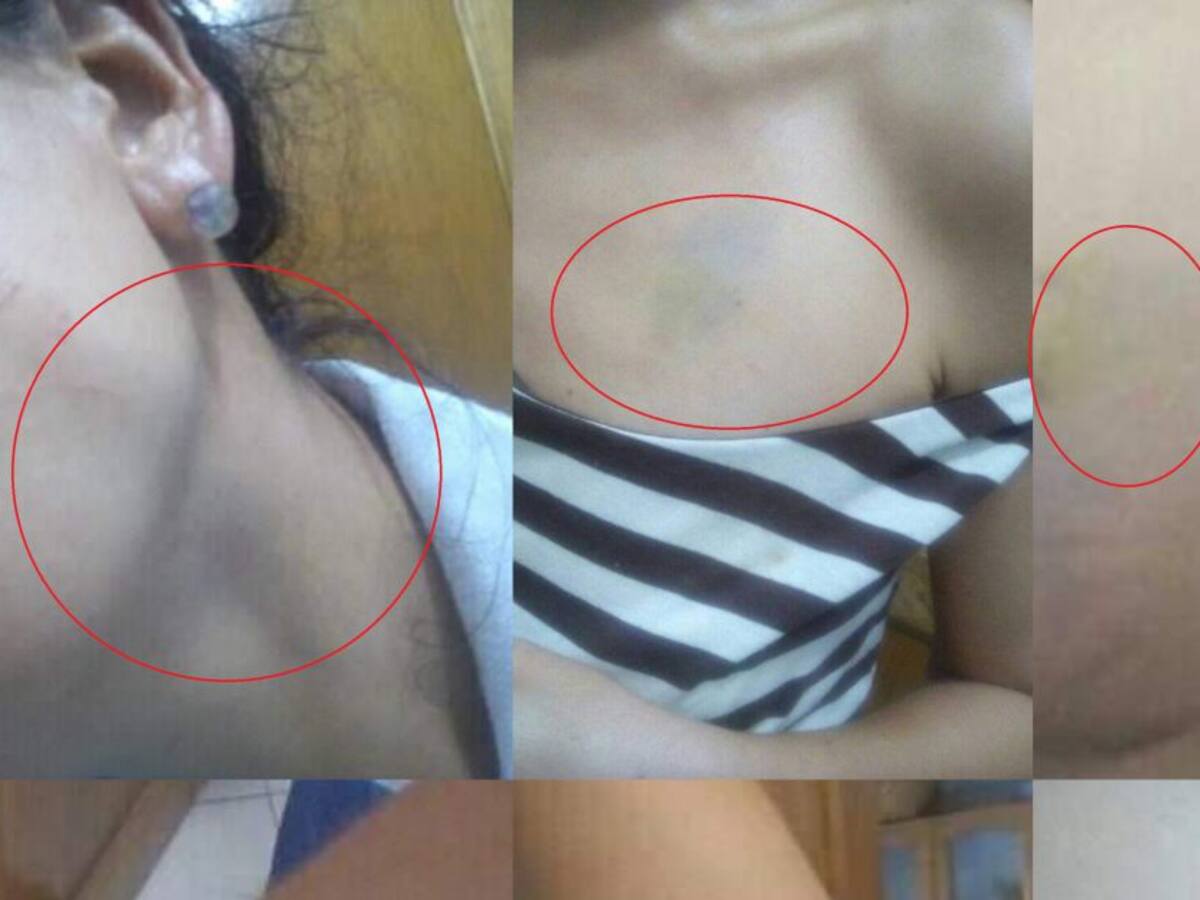 En El Rodadero una mujer denuncia una agresión por exigir el tapabocas