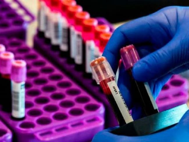 Tres nuevos casos de COVID-19 en Santander