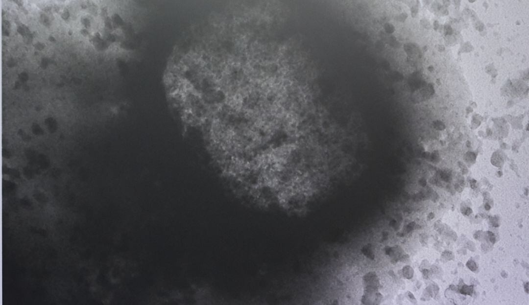 OMS asegura que el brote de viruela del mono "todavía puede controlarse"