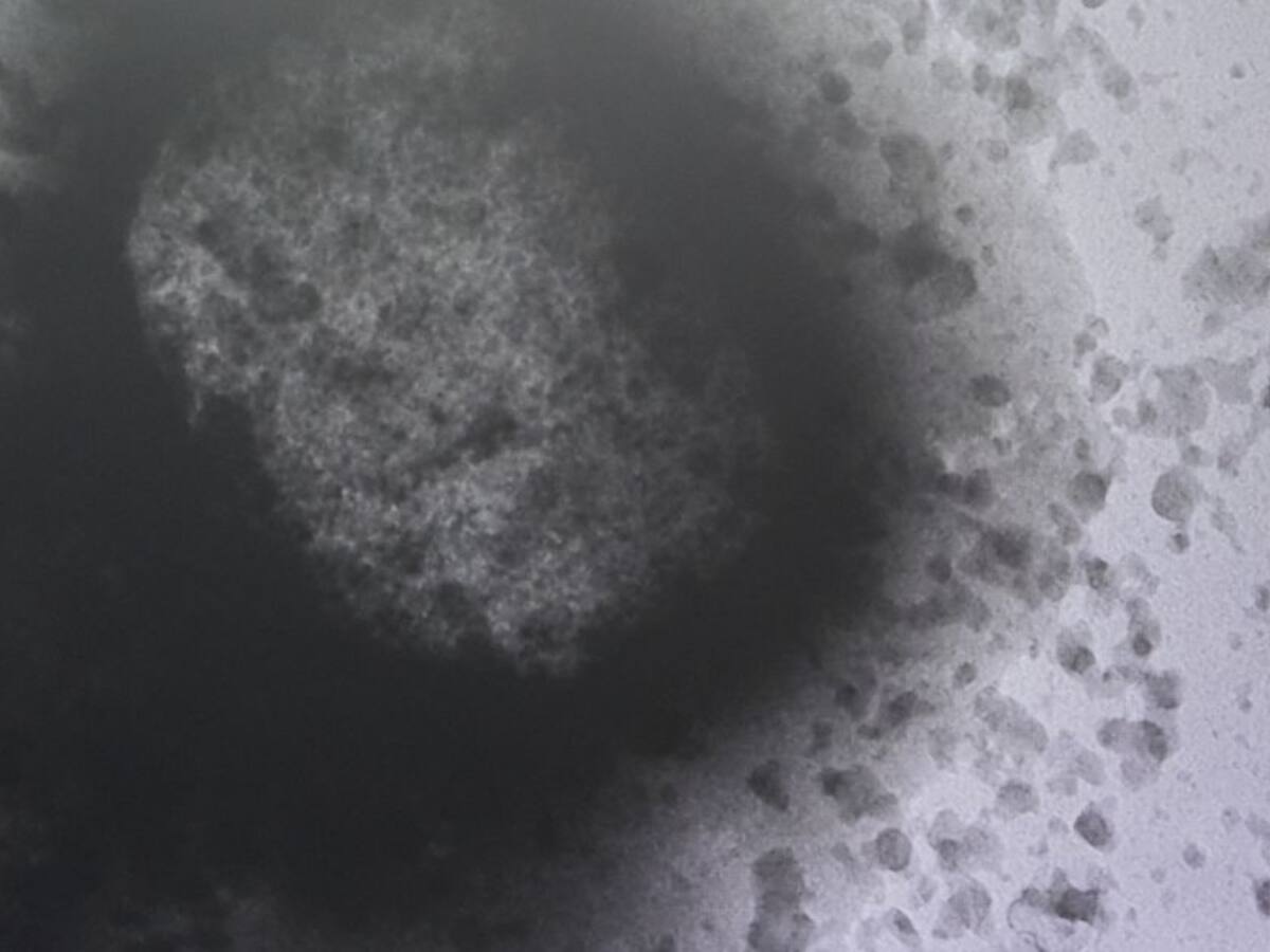 OMS asegura que el brote de viruela del mono "todavía puede controlarse"