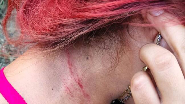 Por un lado, el Comité Antipeajes pide que se levanten las talanqueras y por el otro los empleados de la concesión exigiendo derecho al trabajo