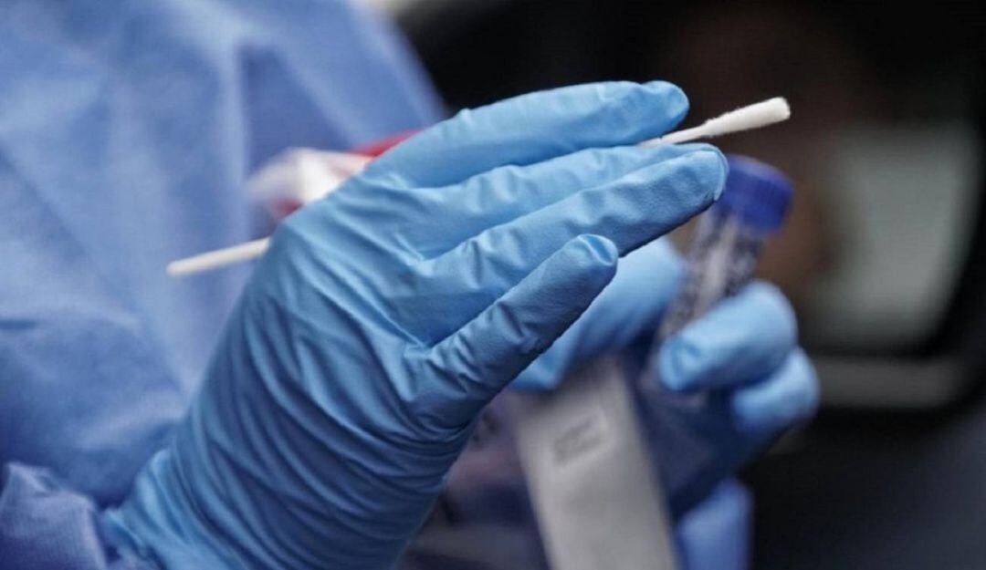 Realización de pruebas PCR