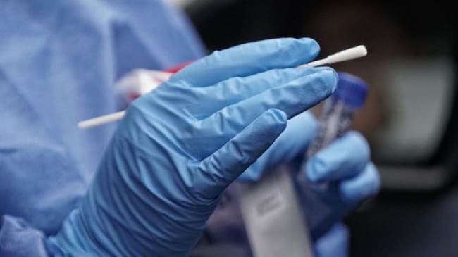 Realización de pruebas PCR