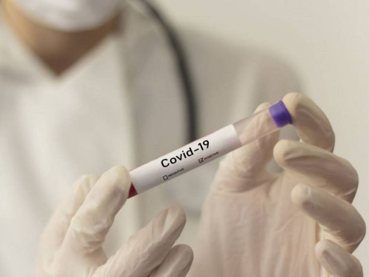 El Quindío superó los 30.000 casos de COVID-19