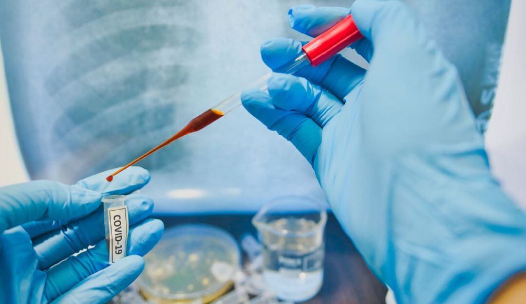 Cuatro fallecidos por COVID 