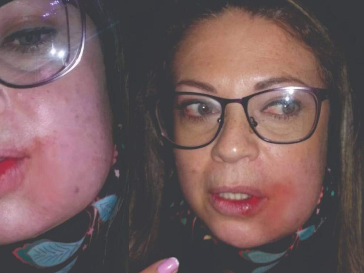 Mujer denuncia agresión por concejal aparentemente borracho en Zipaquirá